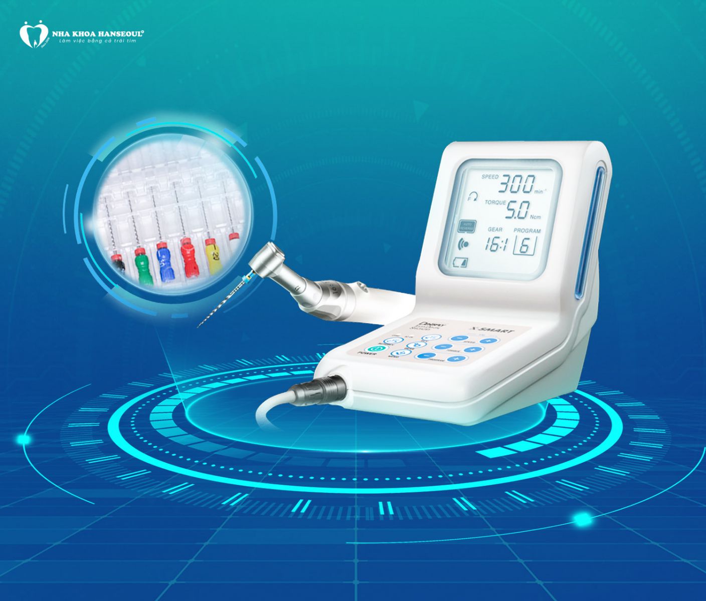 Điều trị nội nha