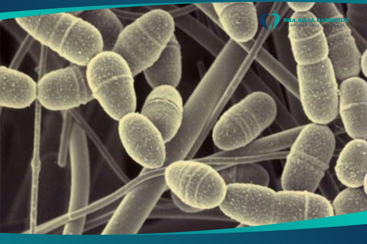 Vi khuẩn gây ra sâu răng