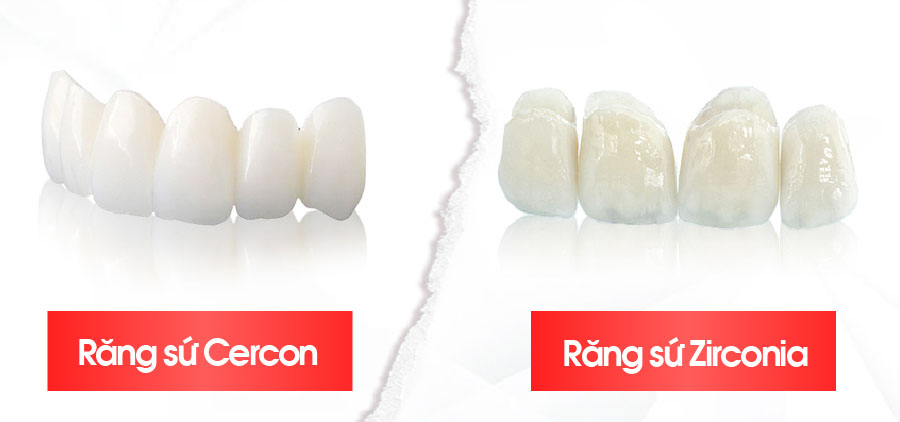 răng sứ Cercon và răng sứ Zirconia răng sứ Cercon và răng sứ Zirconia