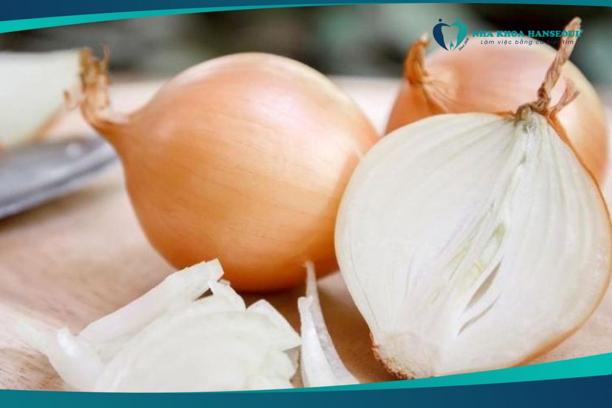Điều trị viêm tủy răng bằng hành tây