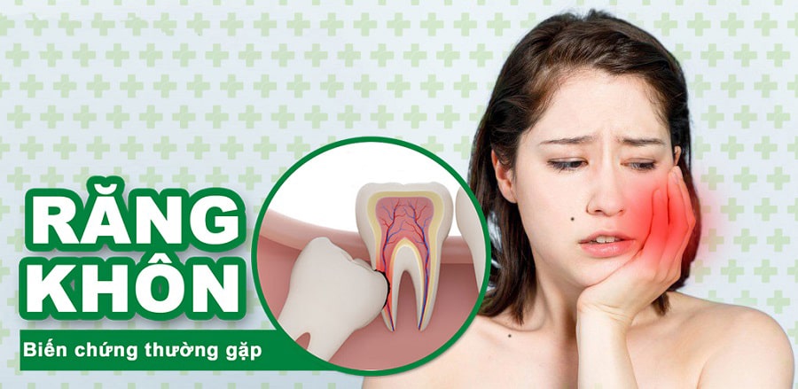 Biến chứng răng khôn