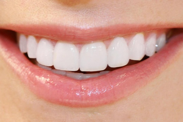 Răng sứ Katana Nhật