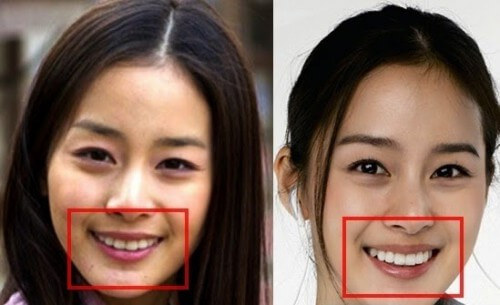 Sao hàn làm răng sứ Sao hàn làm răng sứ