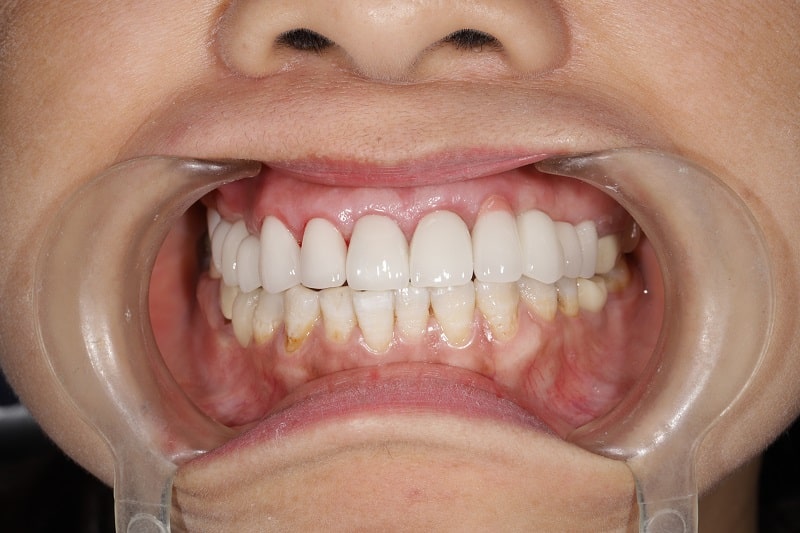 Bệnh nhân tại nha khoa