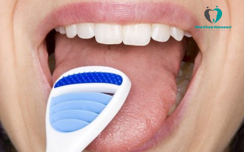 Vệ sinh răng miệng đúng cách sau trồng răng Implant