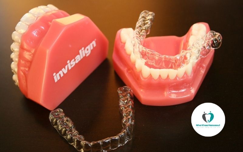 niềng răng invisalign