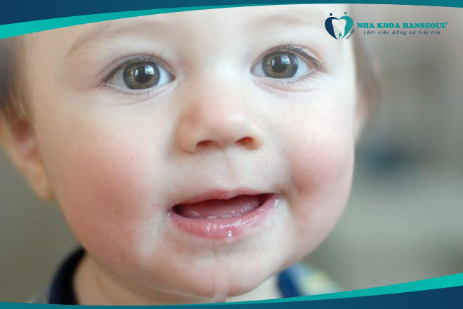 trẻ chảy nhiều nước dãi do mọc răng không đúng thứ tự