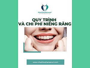 Niềng răng bị bung mắc cài phải làm sao? Hướng xử lý