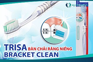 TOP 3 loại bàn chải cho người niềng răng tốt nhất hiện nay