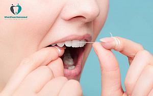 Độ tuổi nào niềng răng là tốt nhất? Có nên niềng răng sớm không?