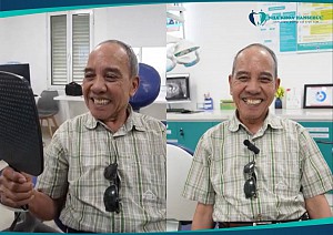 Phục hình răng Implant toàn hàm tại Hanseoul – “10 điểm toại nguyện” từ Việt kiều Đức 74 tuổi