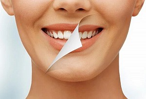 Độ tuổi nào niềng răng là tốt nhất? Có nên niềng răng sớm không?