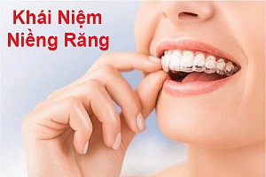 Niềng răng bị bung mắc cài phải làm sao? Hướng xử lý