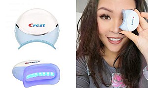 Độ tuổi nào niềng răng là tốt nhất? Có nên niềng răng sớm không?