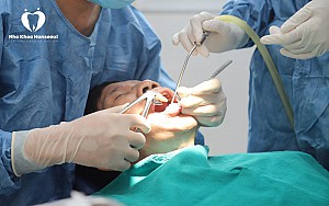 Có nên nhổ răng số 8 khi đang niềng răng?