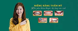 Niềng răng bị bung mắc cài phải làm sao? Hướng xử lý