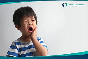 Sử dụng thuốc kháng sinh điều trị viêm tủy răng, nên hay không?