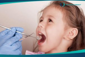 Trẻ 7 tuổi bị sâu răng hàm phải làm sao?
