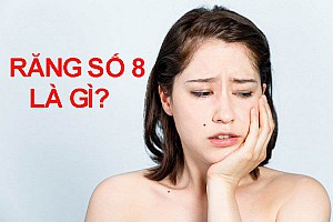 Có nên nhổ răng số 8 khi đang niềng răng?