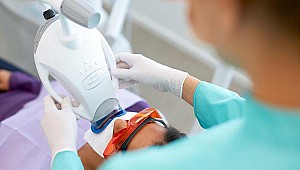 Tẩy trắng răng bao nhiêu tiền và những câu hỏi thường gặp của khách hàng