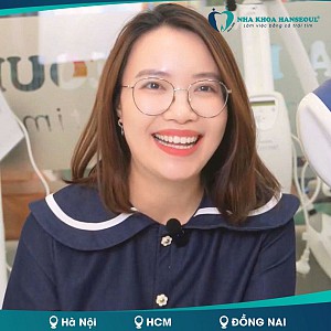Khớp cắn ngược hạng III thay đổi ngoạn mục với Invisalign tại Hanseoul