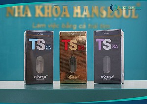 So sánh các loại trụ implant phổ biến hiện nay