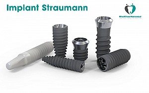 Trồng răng implant có bị hôi miệng không? Cách xử lý hiệu quả