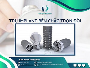 Trồng răng implant có bị hôi miệng không? Cách xử lý hiệu quả
