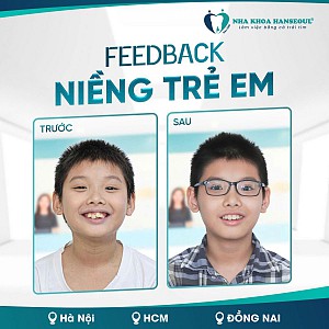 Độ tuổi nào niềng răng là tốt nhất? Có nên niềng răng sớm không?