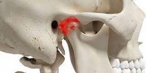 Viêm khớp thái dương hàm là bệnh gì? Cách điều trị viêm khớp thái dương cực kỳ đơn giản