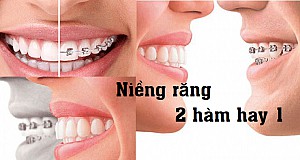 Niềng răng bị bung mắc cài phải làm sao? Hướng xử lý