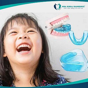 Niềng răng bị bung mắc cài phải làm sao? Hướng xử lý