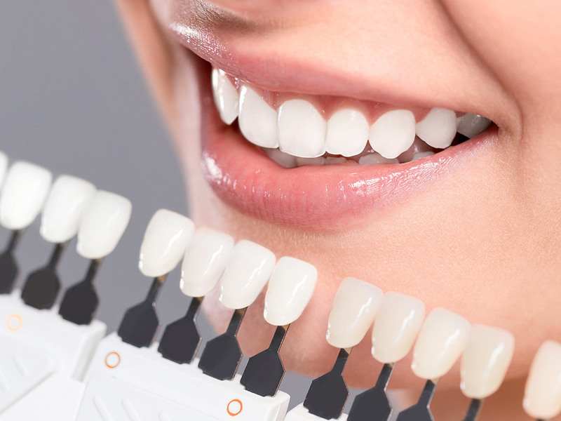 hỗ trợ bọc răng sứ Nano 5S hỗ trợ bọc răng sứ Nano 5S