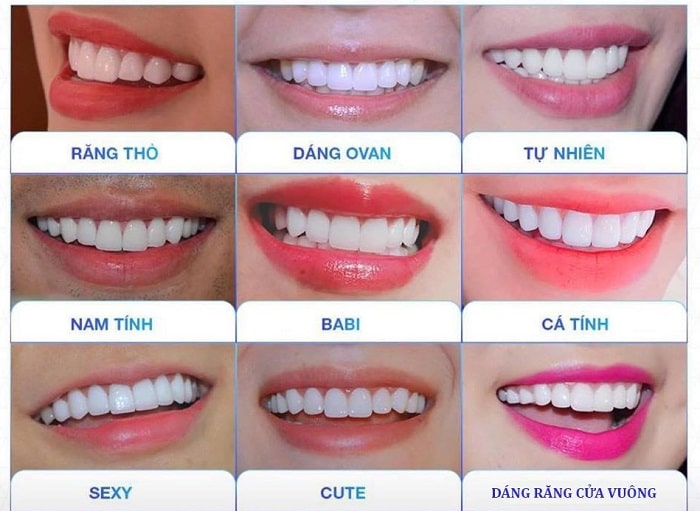 Các dạng răng sứ đẹp