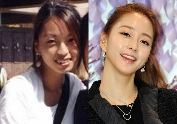 Diễn viên Hàn bọc răng sứ Diễn viên Hàn bọc răng sứ