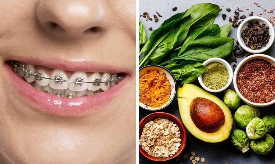 Món ăn mềm cho người niềng răng Món ăn mềm cho người niềng răng