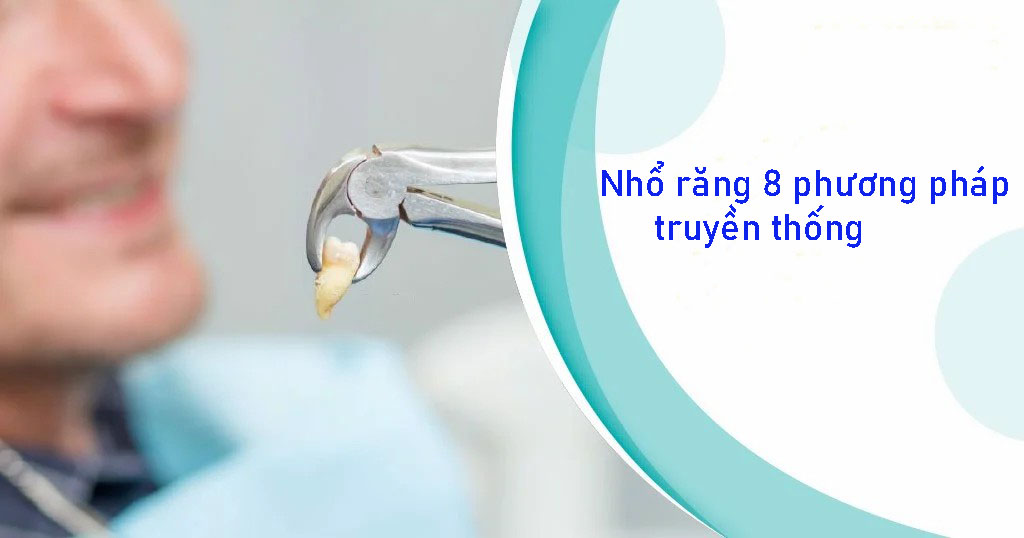 Nhổ răng 8 bằng phương pháp truyền thống Nhổ răng 8 bằng phương pháp truyền thống