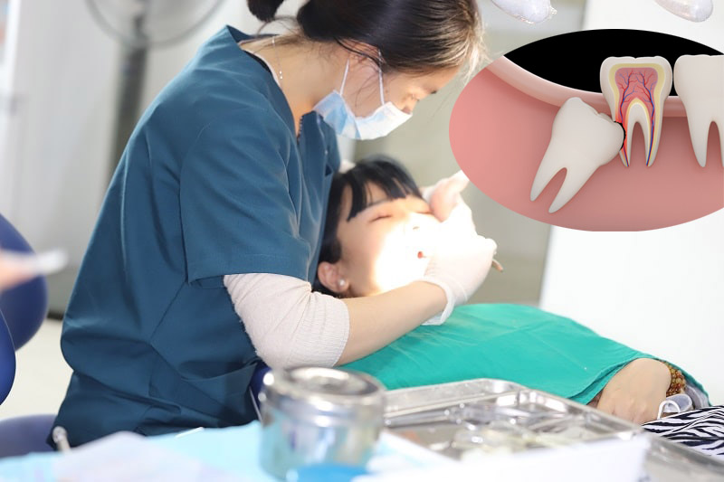 địa chỉ nhổ răng khôn uy tín