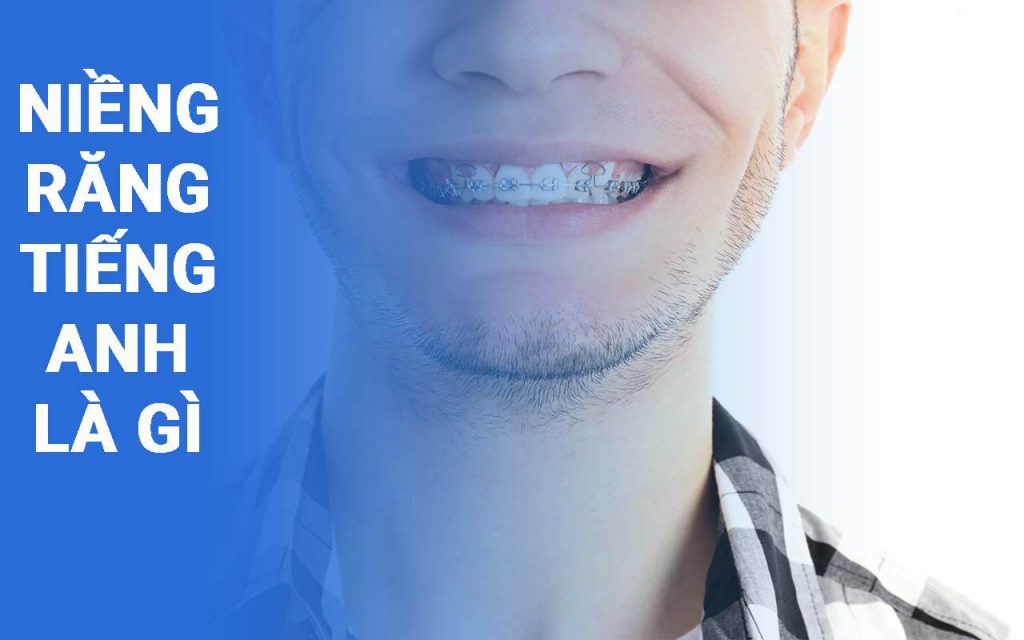 Niềng răng tiếng anh là gì Niềng răng tiếng anh là gì