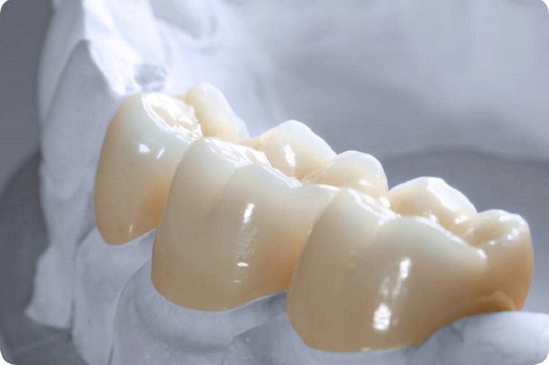 Răng sứ zirconia Răng sứ zirconia
