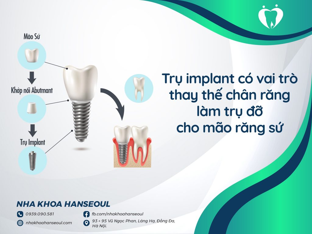 trụ implant