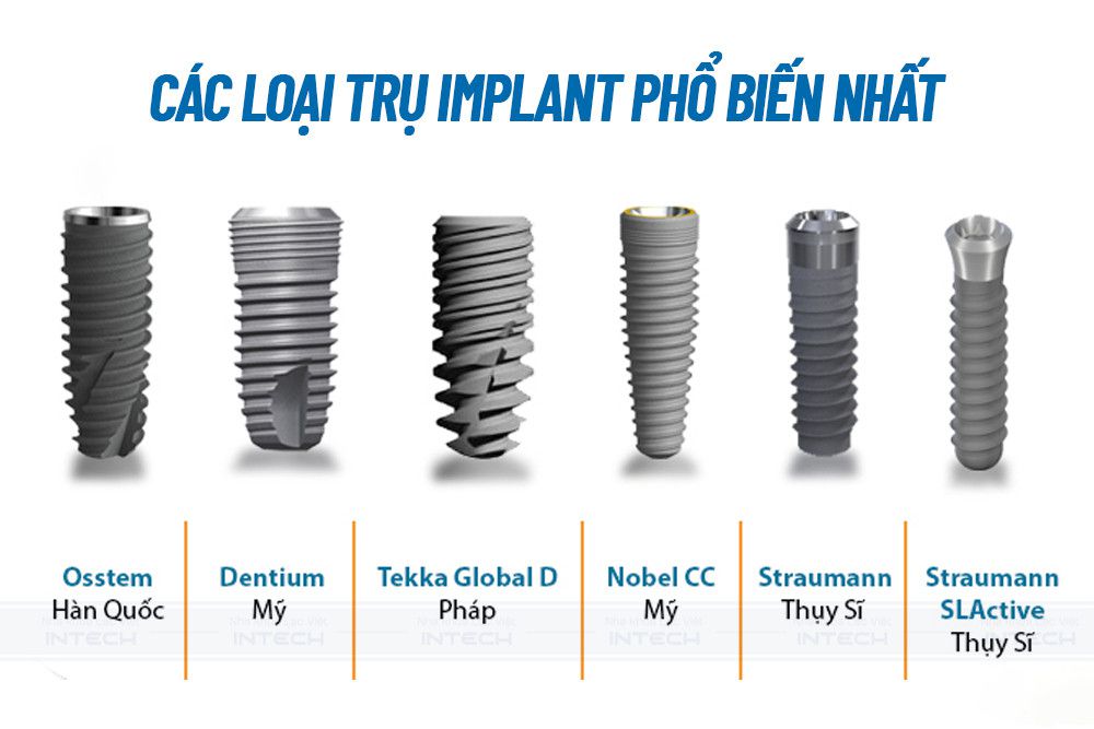 Các loại trụ implant phổ biến Các loại trụ implant phổ biến